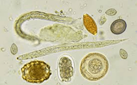 Паразиты и гельминты